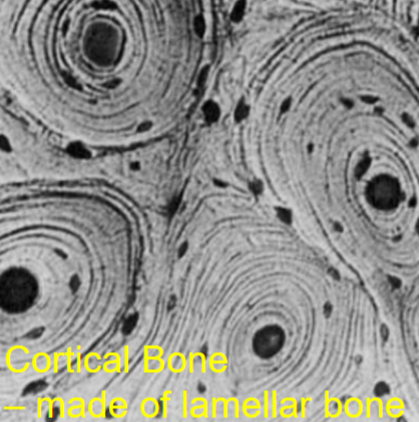<p><u>Compact bone</u> found in the shaft of long bones, made of lamellar bone</p>