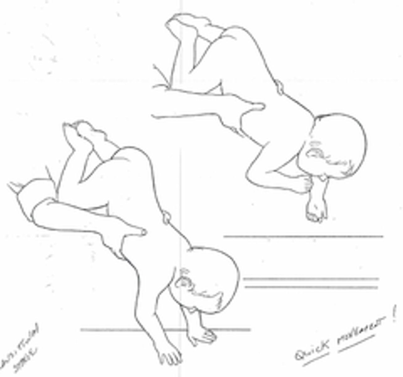 <p>putting arms out when falling/leaning forward</p><p>- example: toddler learning to walk and falls forward</p>