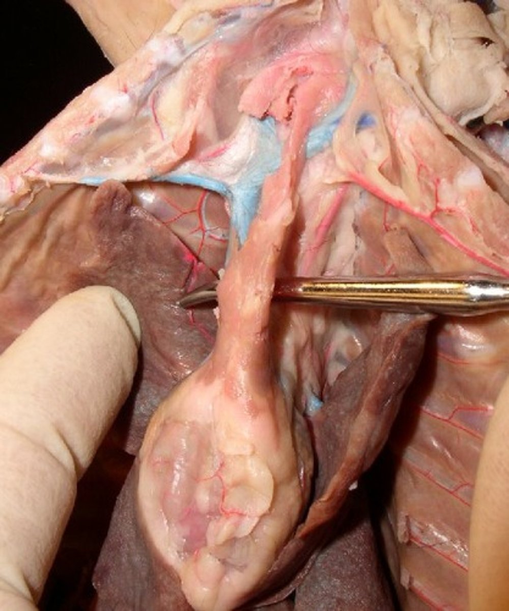 <p>large tube above heart</p>
