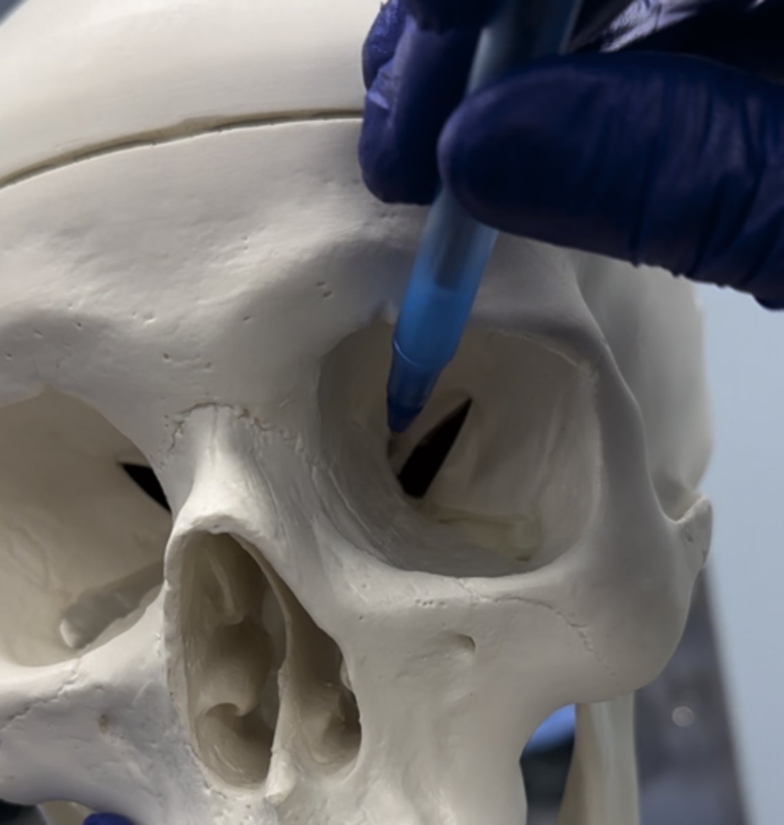 <p>The hole shown that is "upper" is the</p>