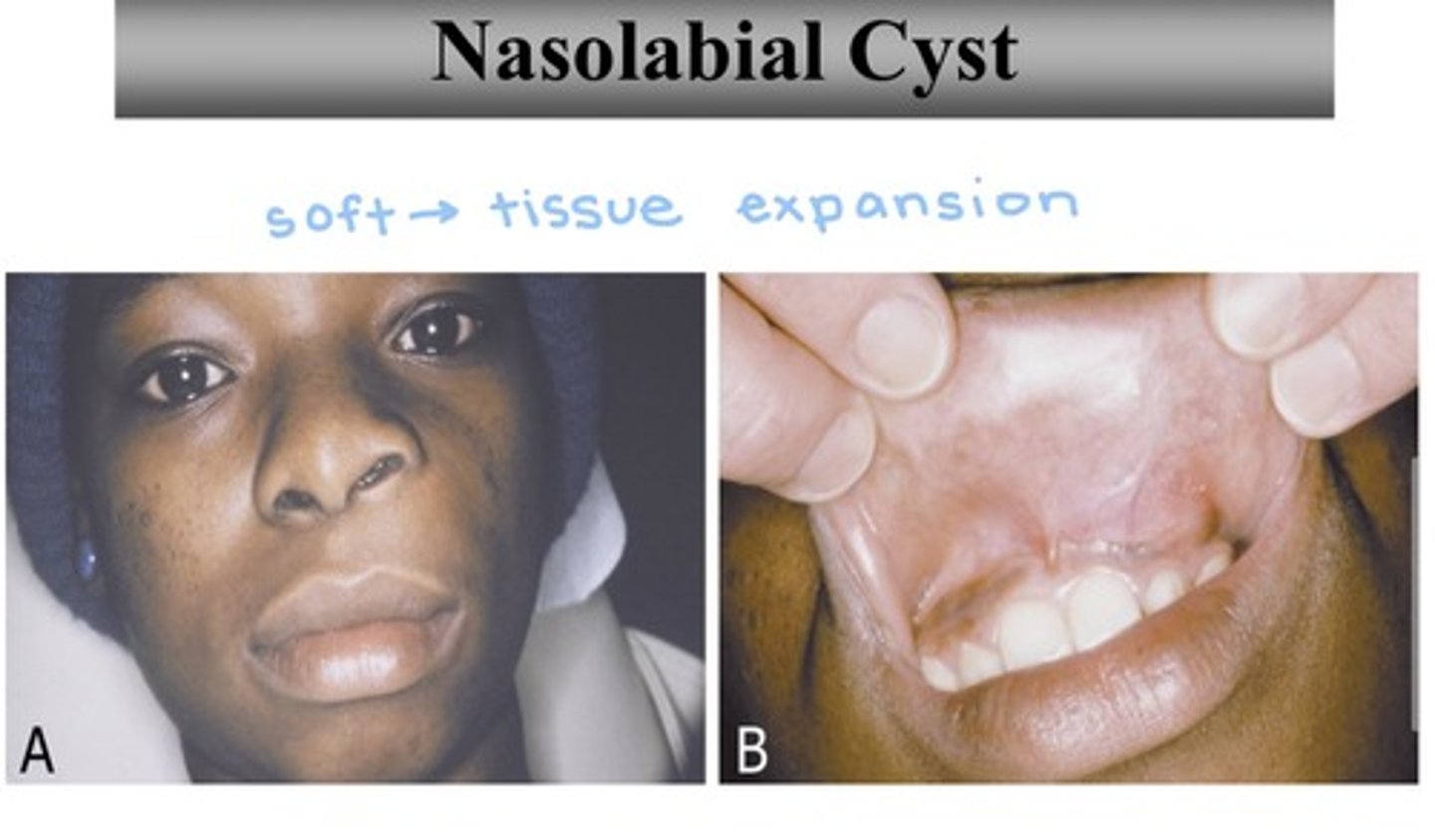 <p>- cause: unknown</p><p>- population: middle aged females (40-50)</p>