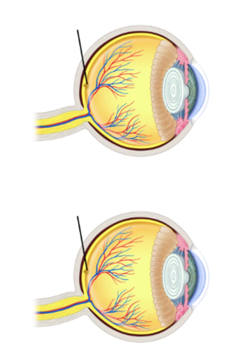 <p>Identify structure.</p>
