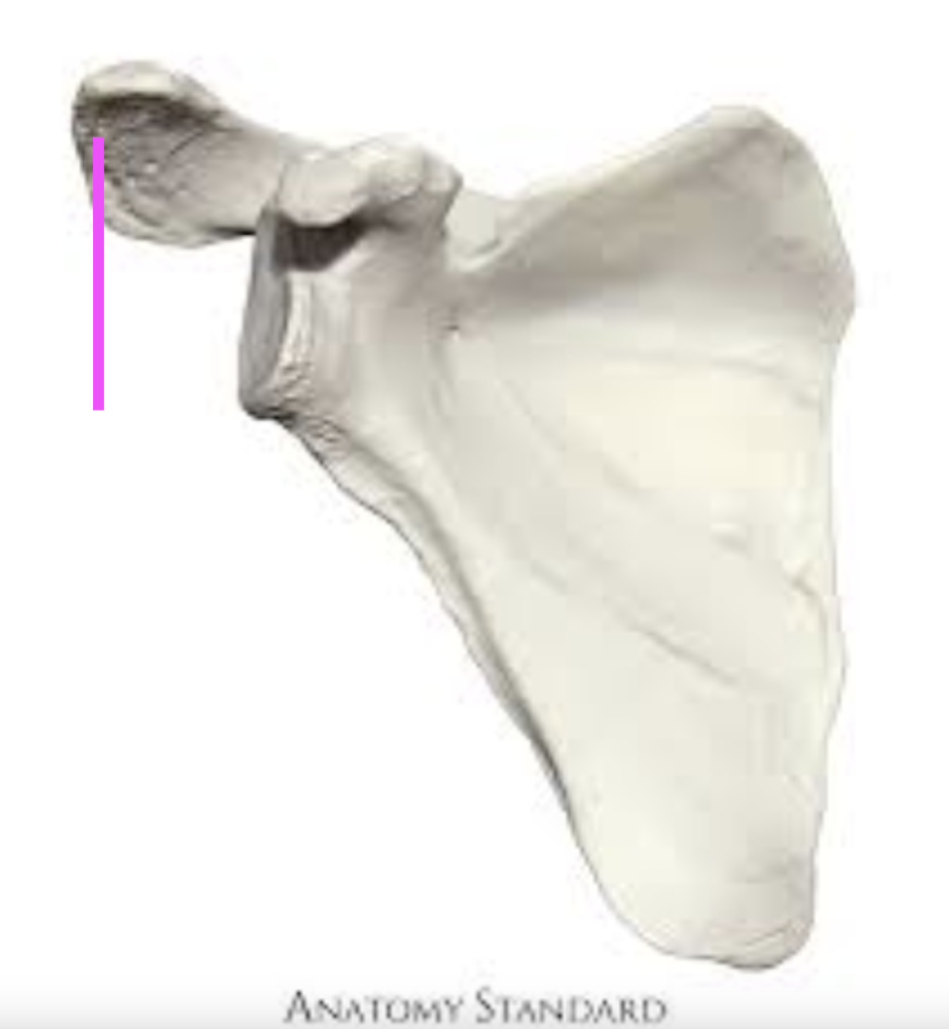 <p>what part of the scapula is this?</p>