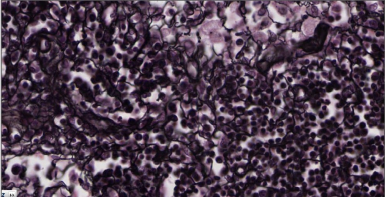 <p>Fibras reticulares</p>