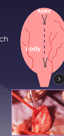 <p><span>Surgical Principles of the Bladder</span></p>