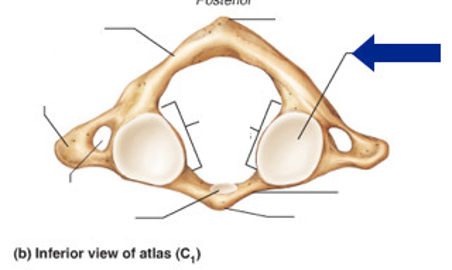 <p>What bone is this?</p>