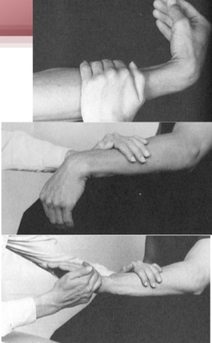 <p>alkar a csuklóig alátámasztva, rögzítem, kéz lelóg pronatióban</p><p>> volarflexióból és radialdeviatióból végezze az előbbi mozgást (dorsalflexio+ ulnardeviatio)</p>