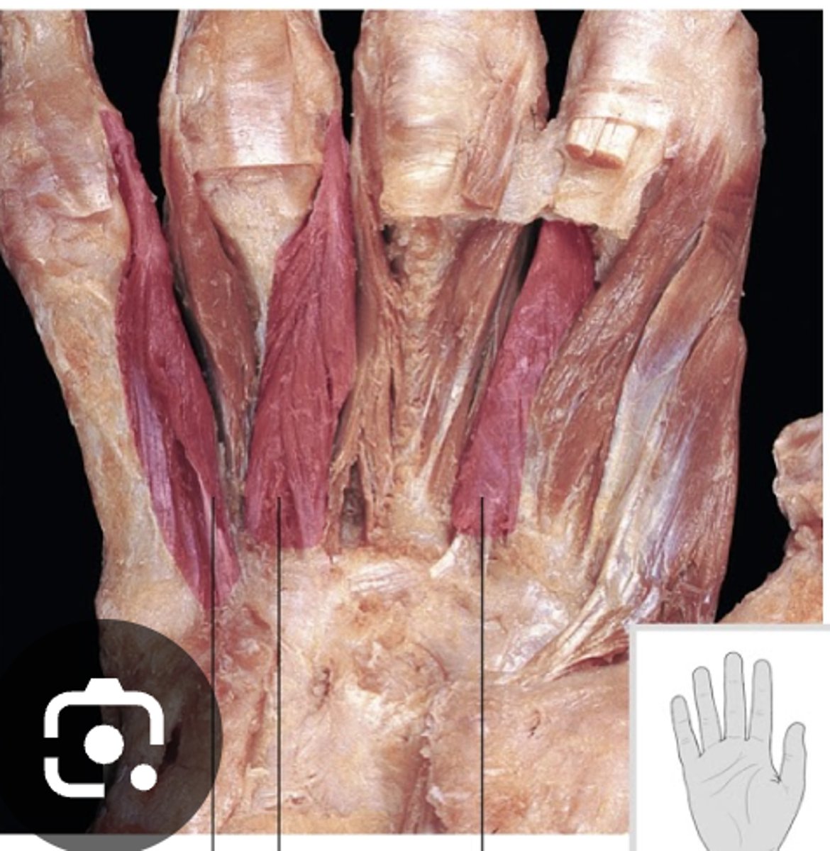 <p>ID muscle</p>