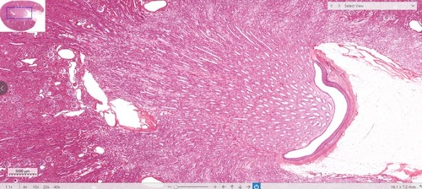 <p>Identify this urinary system structure (U-shaped open space).</p>