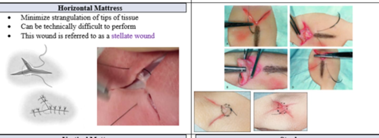 <p>Horizontal Mattress (technically a modified corner stitch)</p>