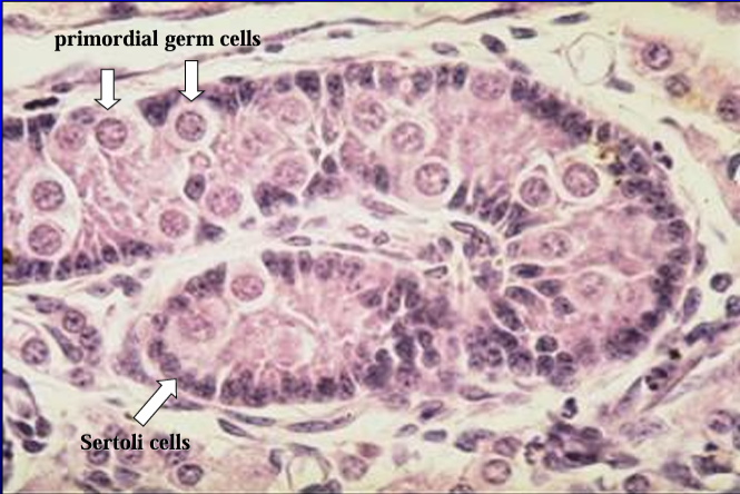<p>Seminiferous tubules, testis of 1-day-old pig. </p><p>The lining epithelium is composed mainly of Sertoli cells (columnar cells with dark nuclei) and primordial germ cells (spermatogonia) - the large round cells. </p><p>Spermatogenesis has not yet begun at this early age and, thus, other spermatogenic cells are not seen in the section</p>