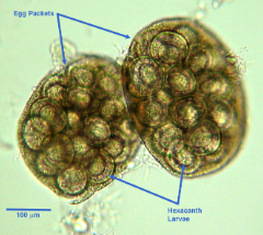 <p>What is the genus, species, and stage of this parasite?</p><p>• 25-49 μm</p><p>• Thin walled with hexacanth oncosphere</p><p>• Passed in packets containing 8-15 eggs</p>