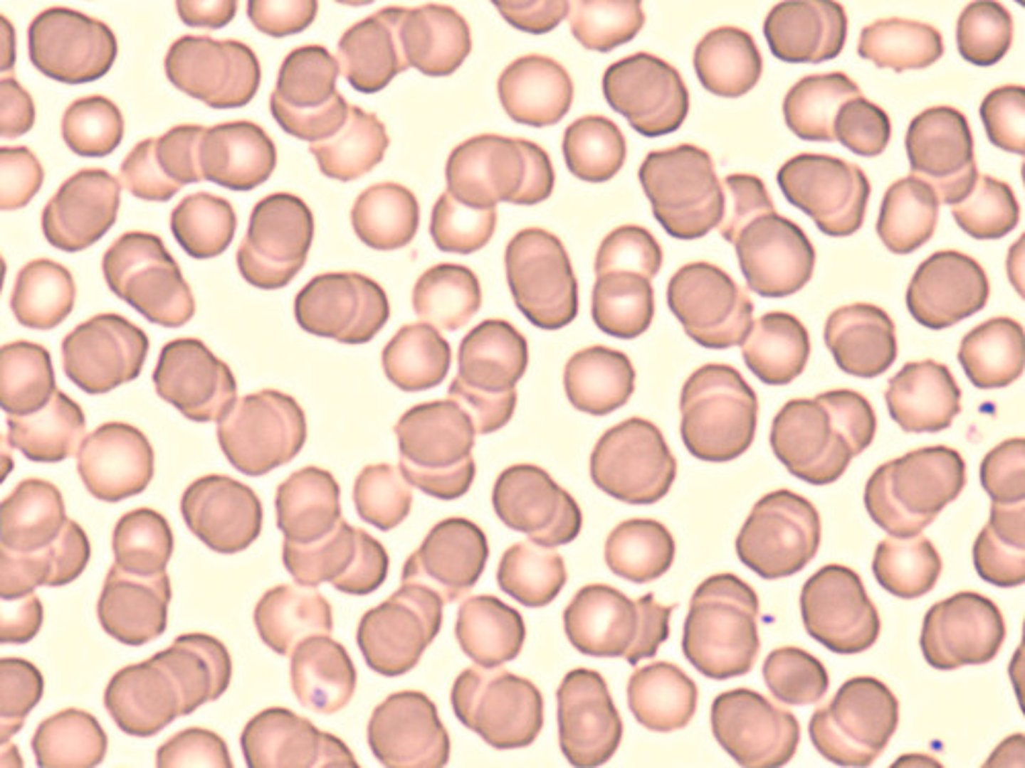 <p>most numerous blood cells that are reddish pink colored and lack a nucleus &amp; most organelles</p>