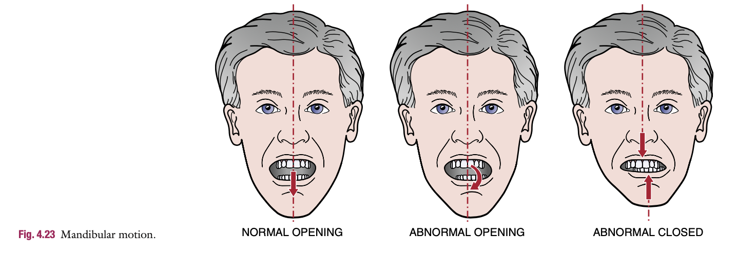 <p>Normal movement of jaw in opening &amp; closing</p>