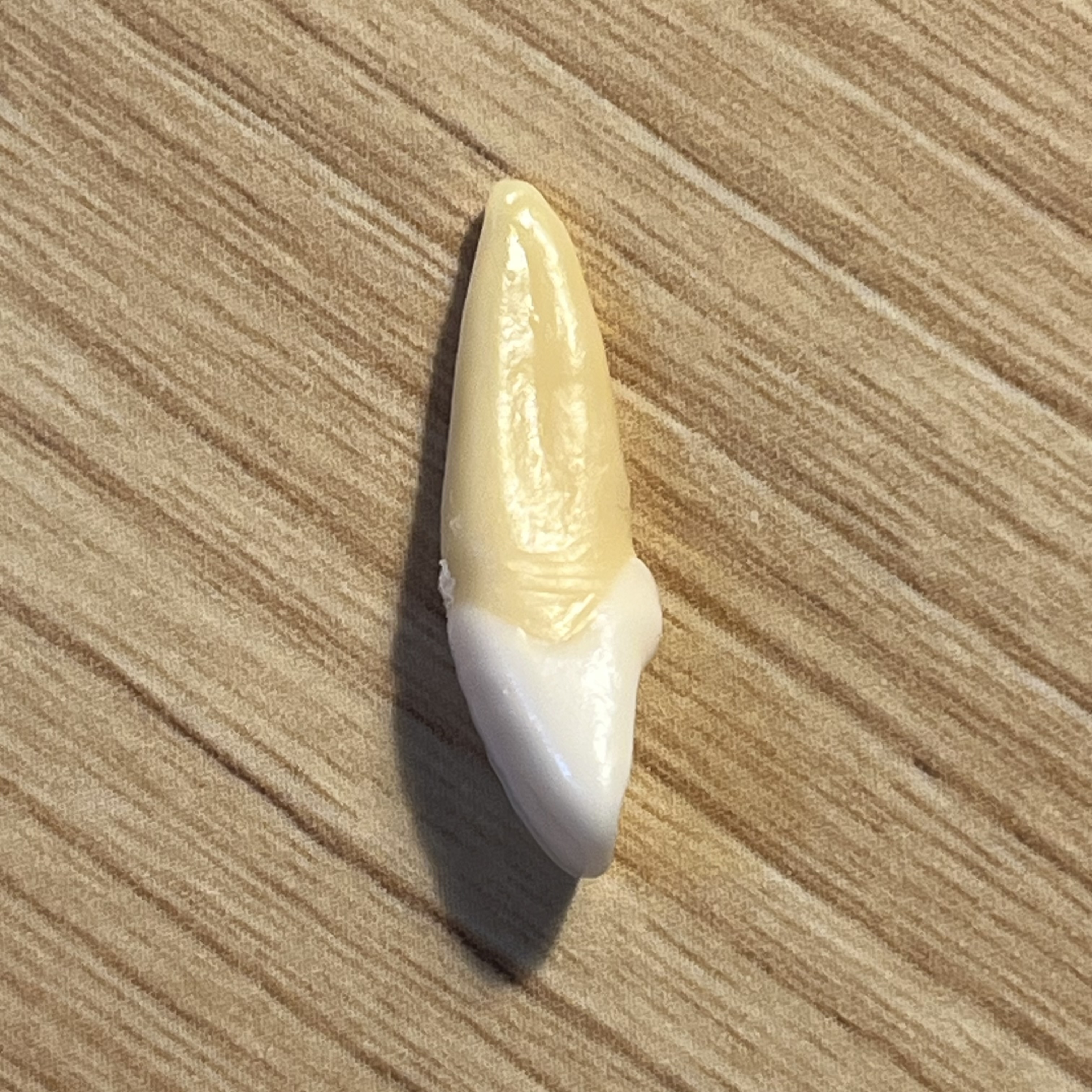<p>What tooth is this (with view)?</p>