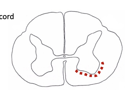 <p><strong>indirect motor pathways</strong></p><ul><li><p>reticulospinal tracts (reticular formation found throughout brainstem)</p><ul><li><p>functions to set ________ (adjust posture) in anticipation of a movement</p></li><li><p>origin = reticular formation in pons and medulla</p></li><li><p>found at all levels of the spinal cord</p></li></ul></li></ul><p></p>