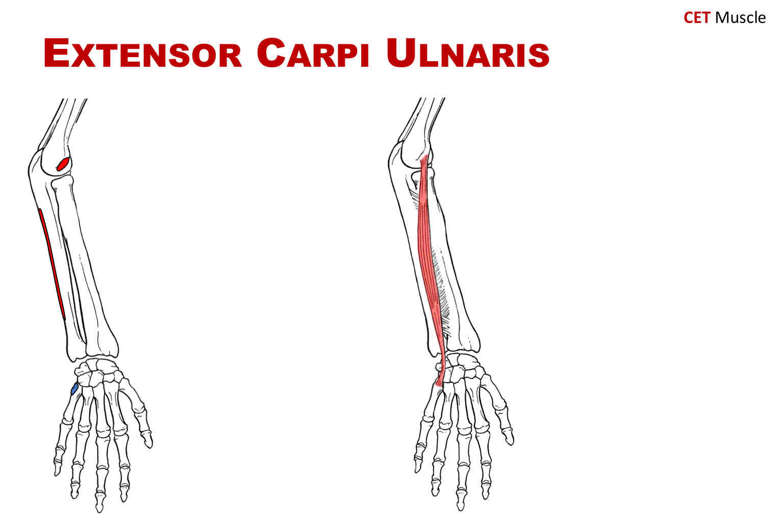 <p>Origin of Extensor Carpi Ulnaris</p>