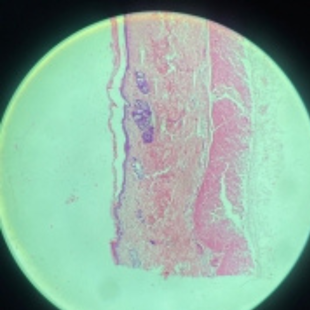 term image