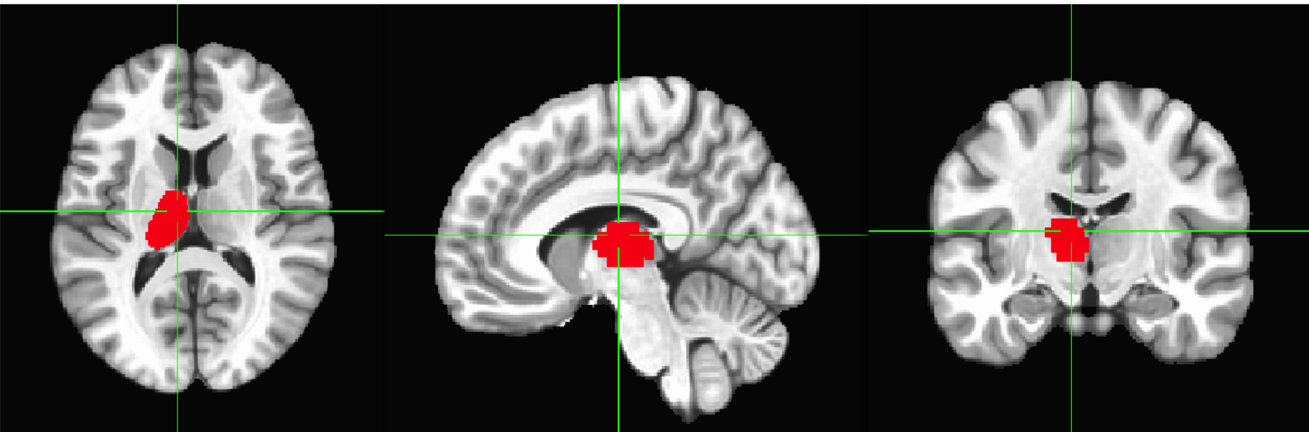<p>A major relay station for sensory information in the brain, where almost all sensory data is filtered before being sent to other brain areas.</p>