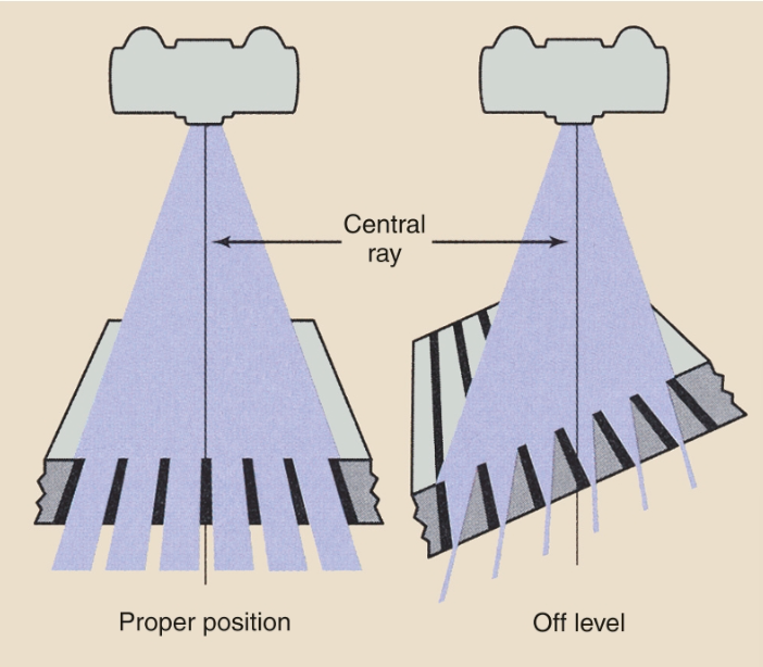 <ul><li><p>occurs when the grid is <span>tilted or </span>off-level resulting in <span>majority of the useful beam being absorbed</span></p></li><li><p>hence, portable grids MUST be <span>perpendicular to the CR</span></p></li></ul><p></p>