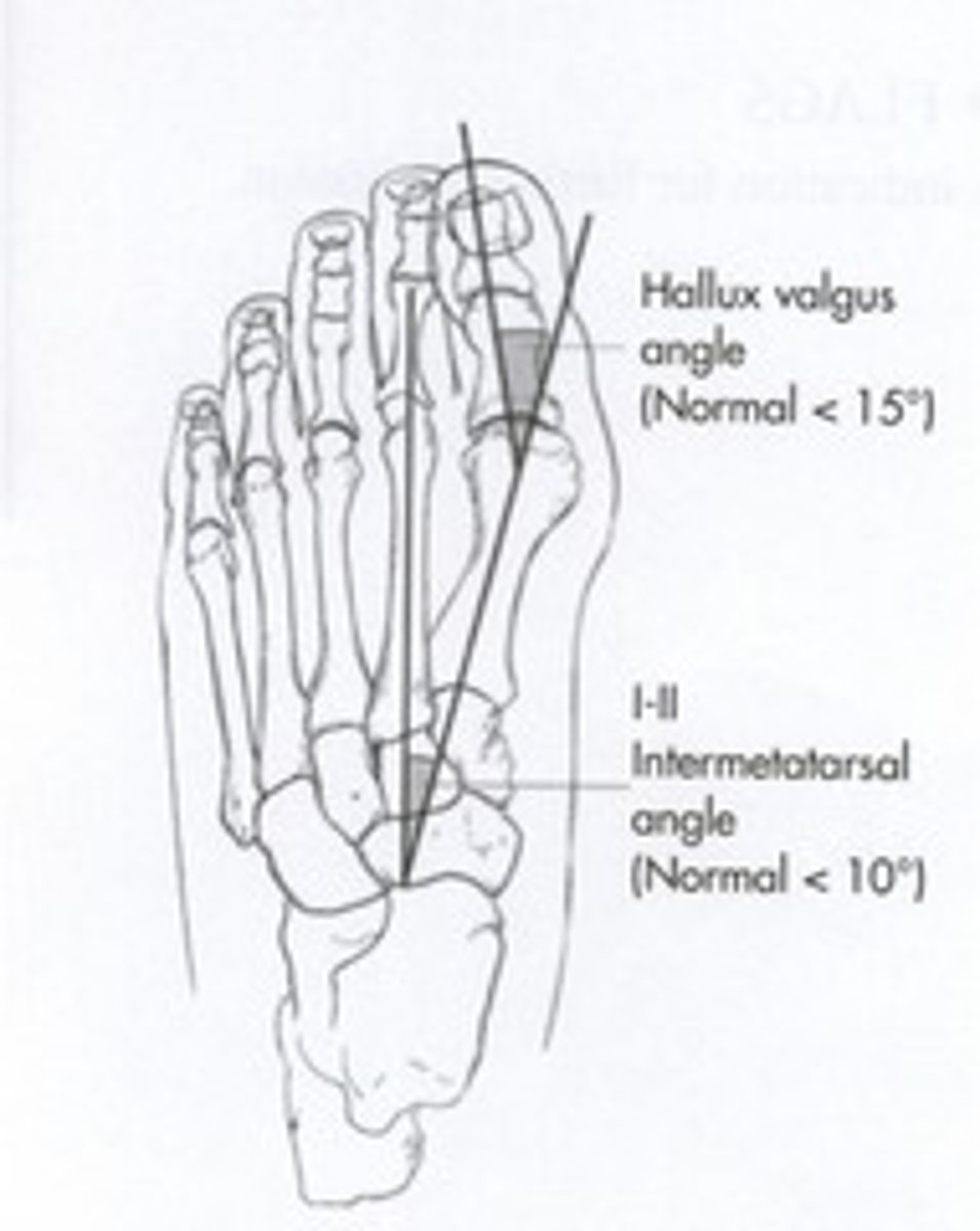 <p>&lt; 15</p>