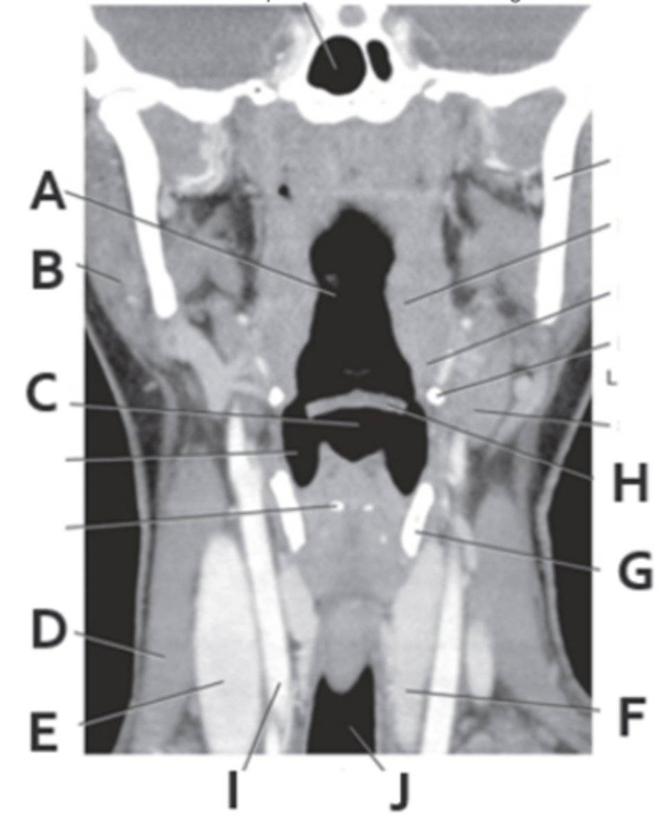 <p>Label F</p>