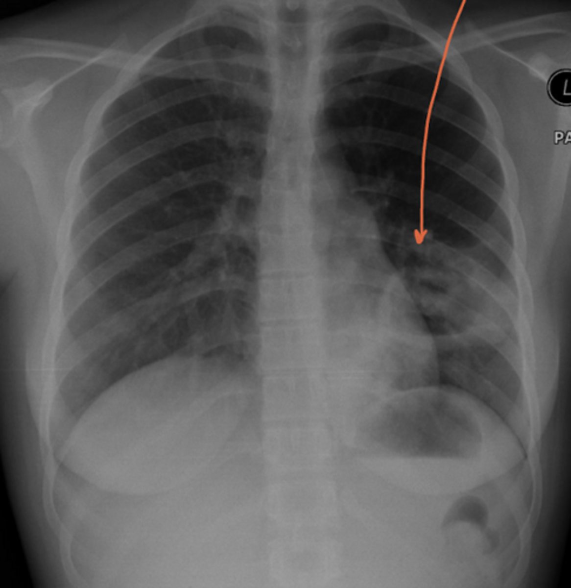 <p>Name the condition</p>