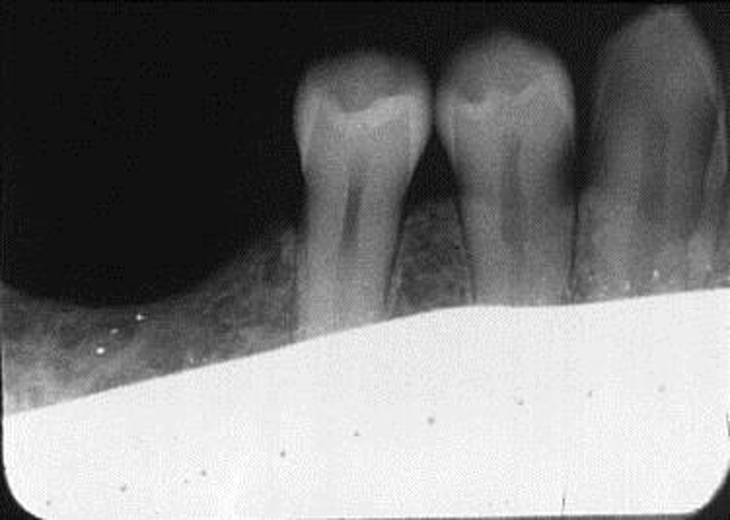 <p>What is this error?</p>