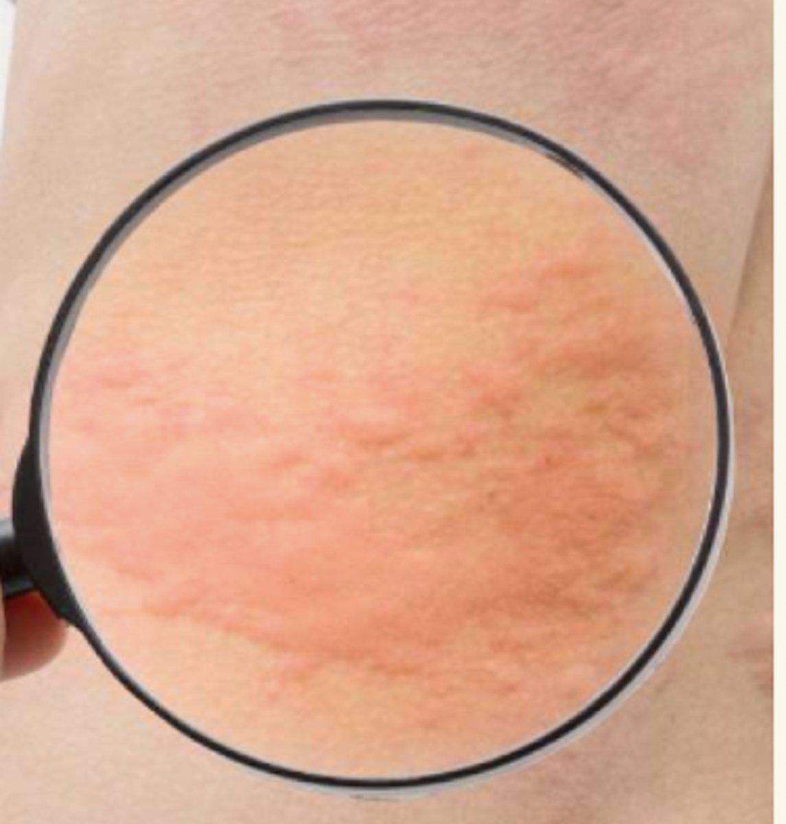 <p>¿lesión?</p><p>¿primaria o secundaria?</p>