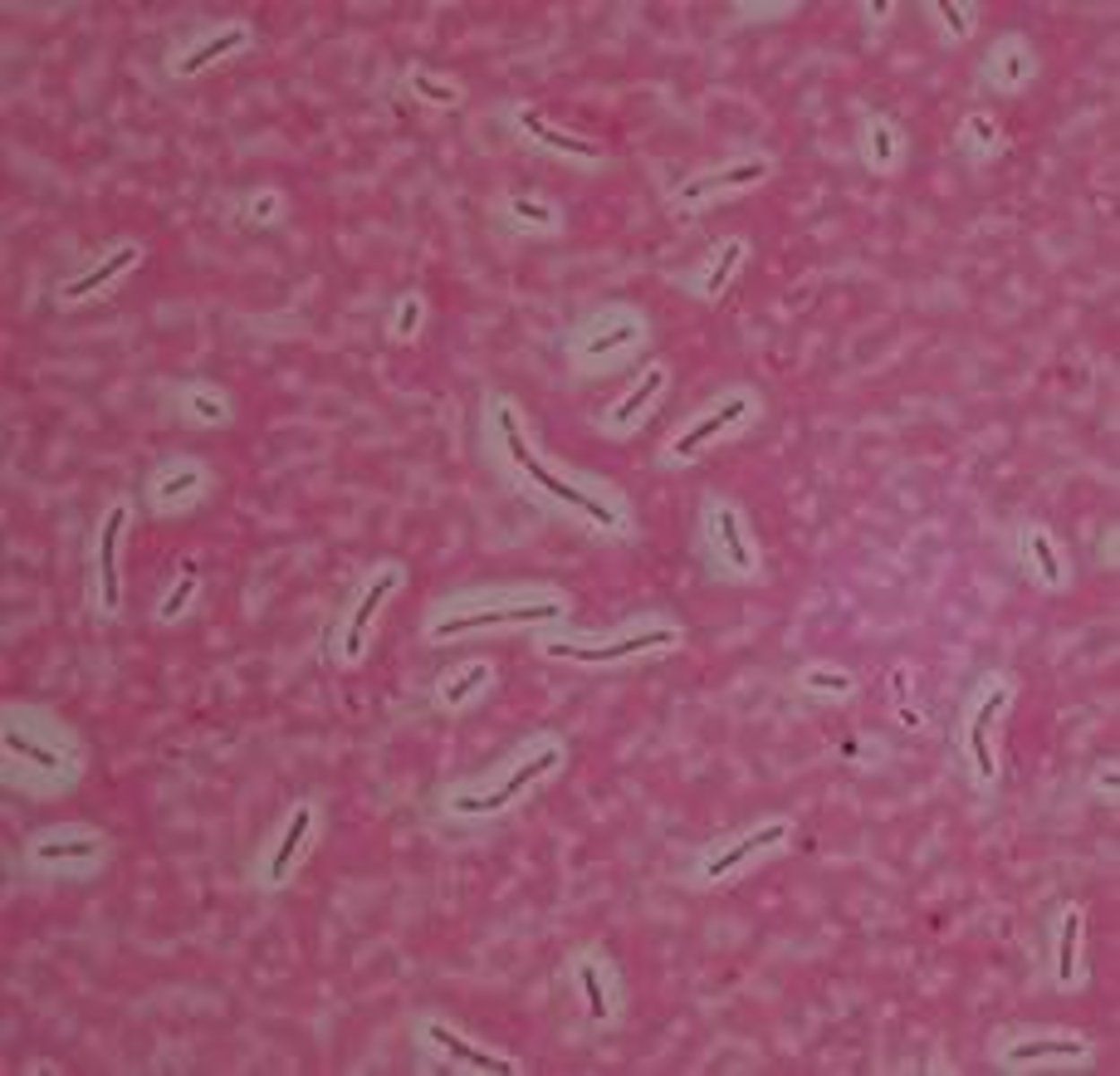 <p>To observe cell shape, size, and arrangement without heat fixing. ex. capsule</p>