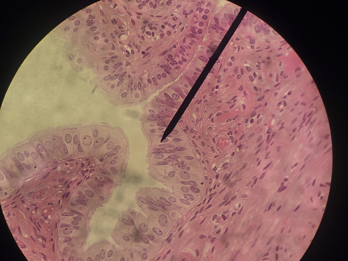 <p>Found in the respiratory tract, lining nasal cavity </p><p>Single layer of cells arranged in columns that almost look like , trachea, bronchi multiple layers. multiply cell types</p>