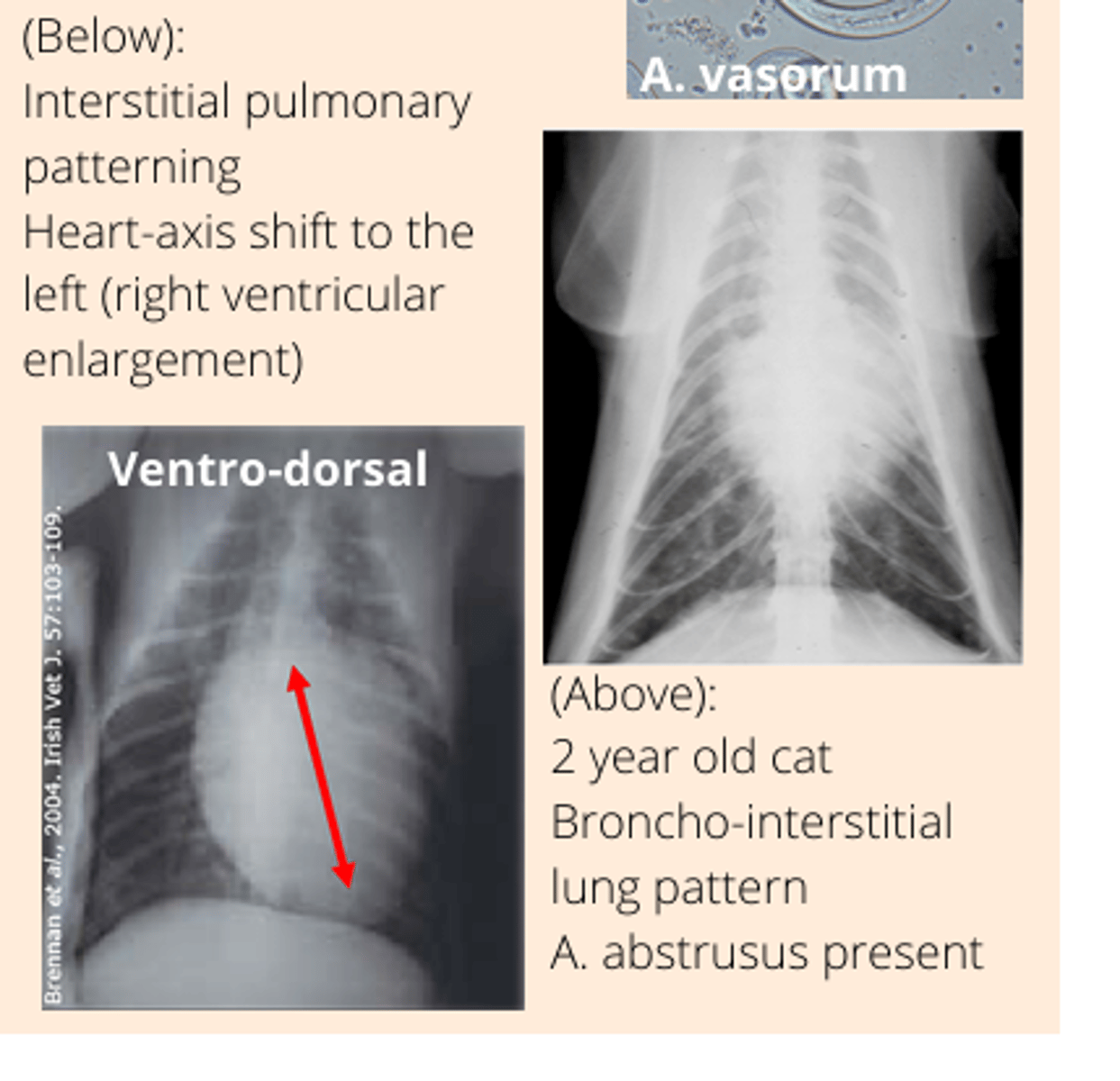 <p>- Interstitual pulmonary patterning</p><p>-right side heart enlargement due to blockage in the pulmonary vessels + dilation..</p>