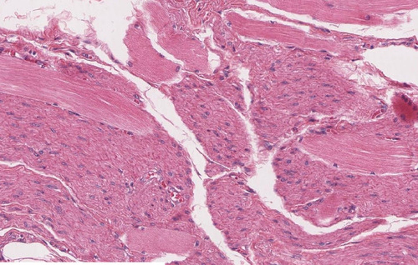 <p>this image is a histological section of the middle 1/3 of the esophagus</p><p>note: the mix of smooth and skeletal muscle representative of the partial voluntary, partial involuntary control of swallowing at this point in the esophagus</p>