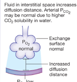 <p>what disease state does this represent</p>
