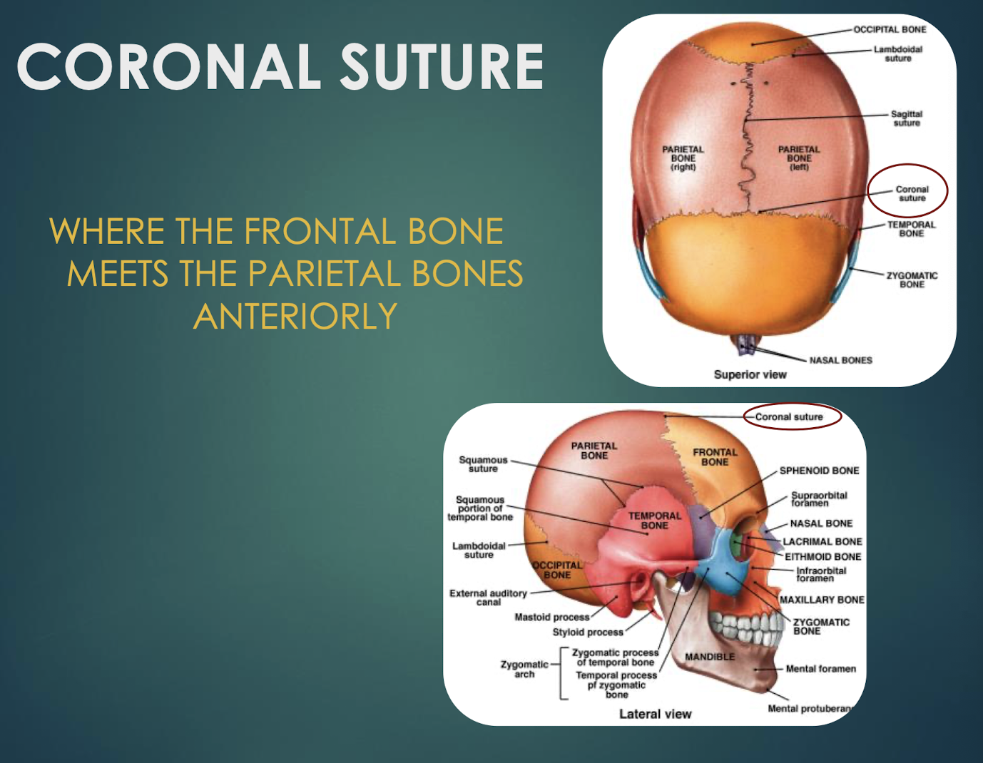 <p>Coronal Suture</p>