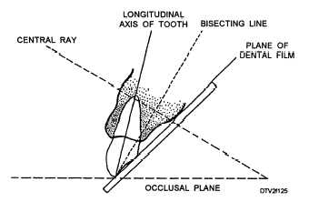 <p>Elongate, Foreshorten, Perfect</p>