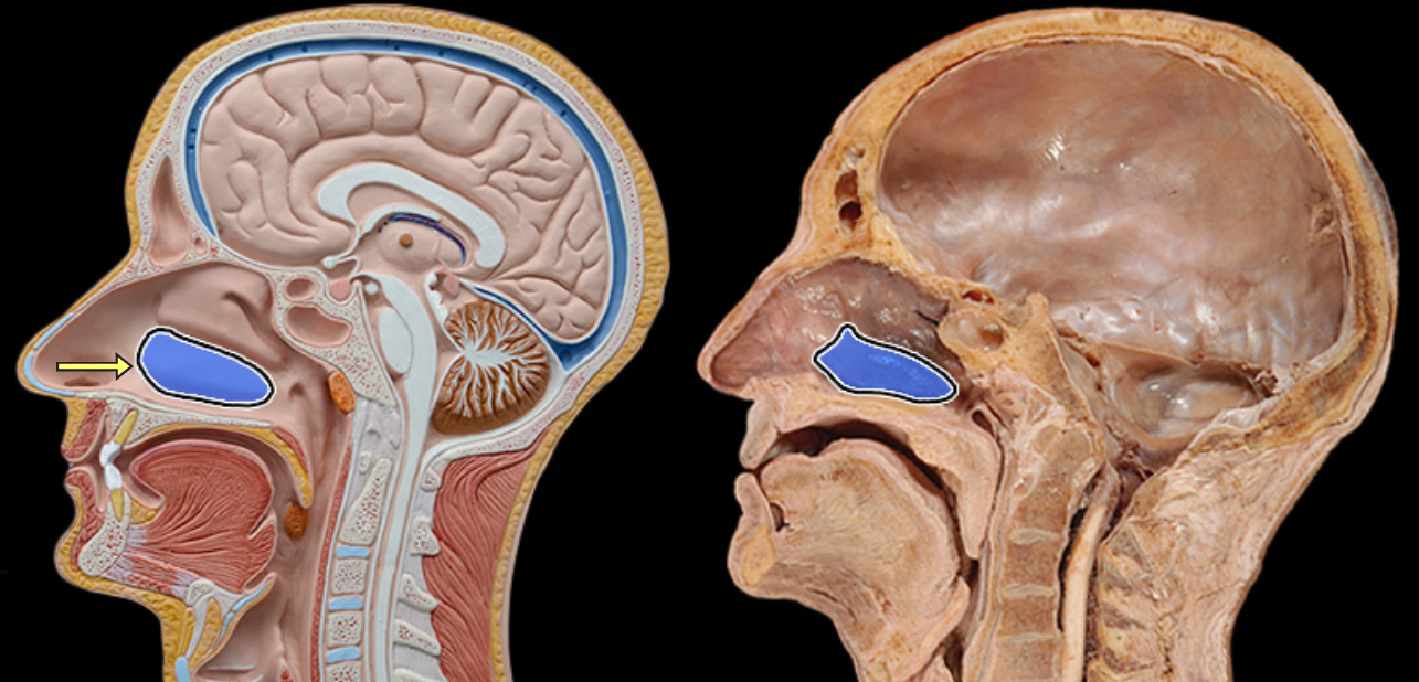 <p>Inferior nasal concha</p>