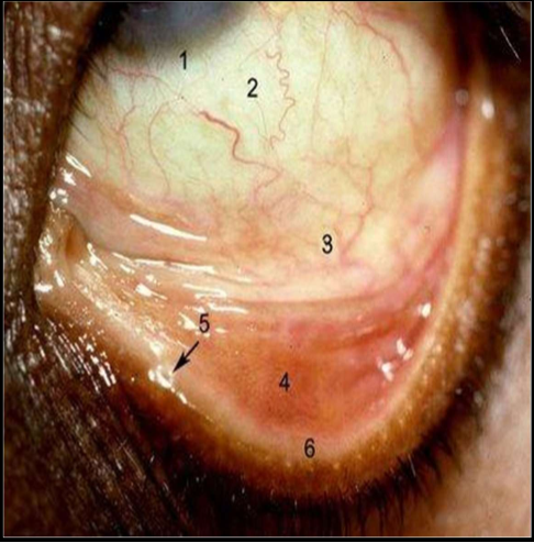 <ol><li><p>Corneoscleral limbus</p></li><li><p>Bulbar Conjunctiva</p></li><li><p>Forniceal Conjunctiva</p></li><li><p>Palpebral Conjunctiva</p></li><li><p>Puncta</p></li><li><p>Mucocutaneous Junction</p></li></ol><p></p>