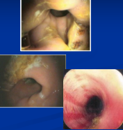 <p><span style="background-color: transparent;">Equine Gastric Ulcer Syndrome</span></p>