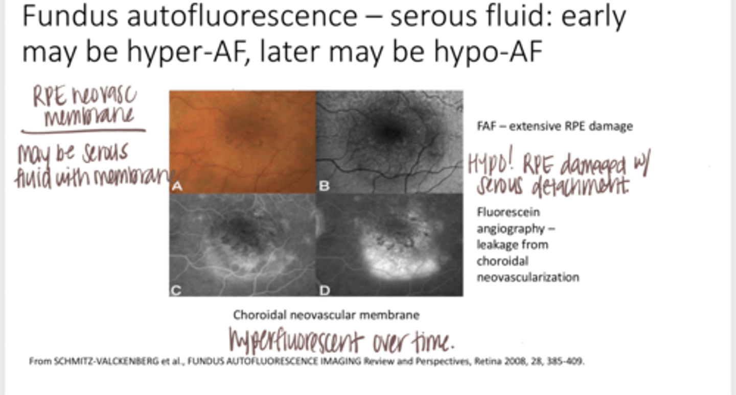 <p>Fundus Autofluorescence -- Serous Fluid (Pic)</p>