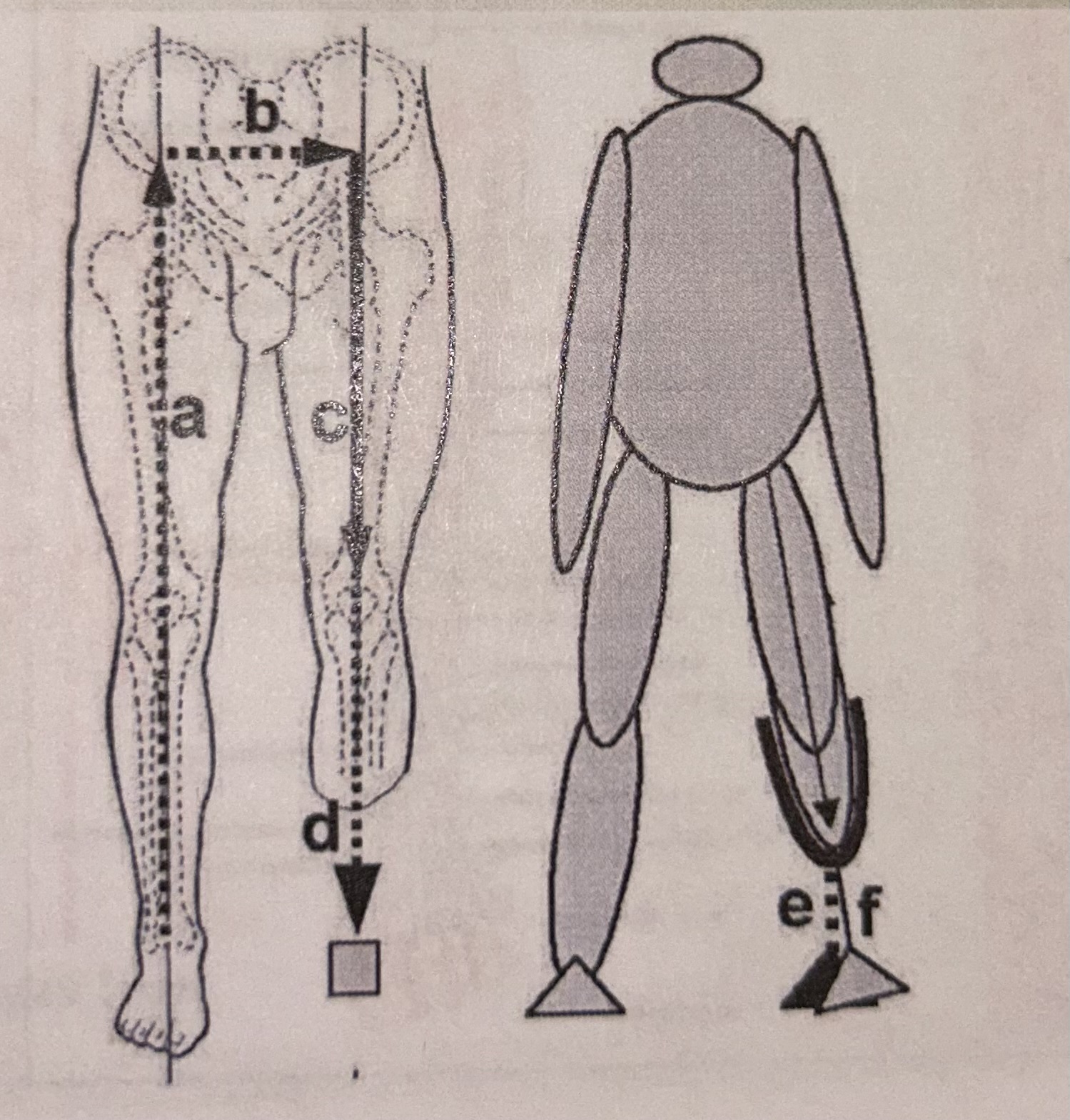 <p>a: palpating the ASIS at the hip level then bisecting the unaffected limb</p><p>b: distance between the hip joints (equal to base of gait)</p><p>c: bisecting amputated limb</p><p>d: then connecting down to the prosthetic ankle</p><p>e, f:  if knee adducted or abducted, causing prosthetic foot compensation - need to place prosthetic device with correct alignment</p>
