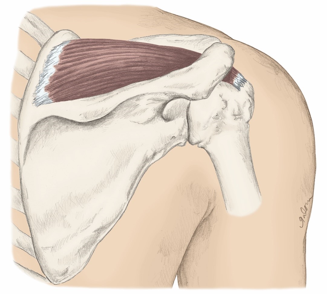 <p>O- Scapula; Supraspinous Fossa</p><p>I- Humerus; Greater Tubercle</p><p>A- Shoulder Abduction</p>
