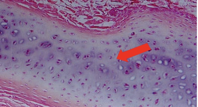 <p>supports and reinforces </p><p>located in the cartilage of the ribs </p>