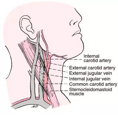 <p>T/F The internal jugular vein</p><p><strong>T -</strong> A. in the upper part of the neck is posterolateral to the internal carotid a.</p><p><strong>T -</strong> B. is accompanied superiorly by the last four cranial nerves.</p><ul><li><p><strong>cranial nerves:</strong></p><ul><li><p><strong>IX (glossopharyngeal), </strong></p></li><li><p><strong>X (vagus)</strong></p></li><li><p><strong>XI (accessory)</strong></p></li><li><p><strong>XII (hypoglossal)</strong> in the upper neck.</p></li></ul></li><li><p>found in the <strong>carotid sheath</strong> with the IJV and ICA.</p></li></ul><p><strong>F -</strong> C. is posterior to vagus nerve</p><ul><li><p>IJV is <strong>lateral</strong>, the <strong>carotid artery is medial</strong>, and the <strong>vagus nerve is in between them</strong>.</p></li></ul><p><strong>F -</strong> D. has inferiorly the sympathetic trunk lying between the vein and common carotid artery.</p><ul><li><p><strong>sympathetic trunk</strong> runs <strong>posterior</strong> to the <strong>carotid sheath</strong></p></li></ul><p><strong>T -</strong> E. lies on the cervical plexus.</p><ul><li><p><strong>cervical plexus</strong> is deep to the <strong>sternocleidomastoid</strong></p></li><li><p><strong>cervical plexus</strong> formed by <strong>anterior rami of C1-C4</strong></p></li></ul><p></p>