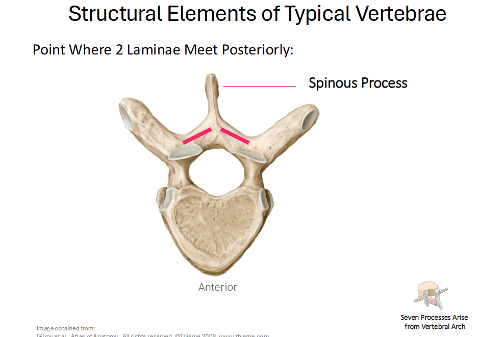 <p><strong>Spinous Process</strong></p><ul><li><p>Point where 2 Laminae meet posteriorly</p></li></ul><p></p>