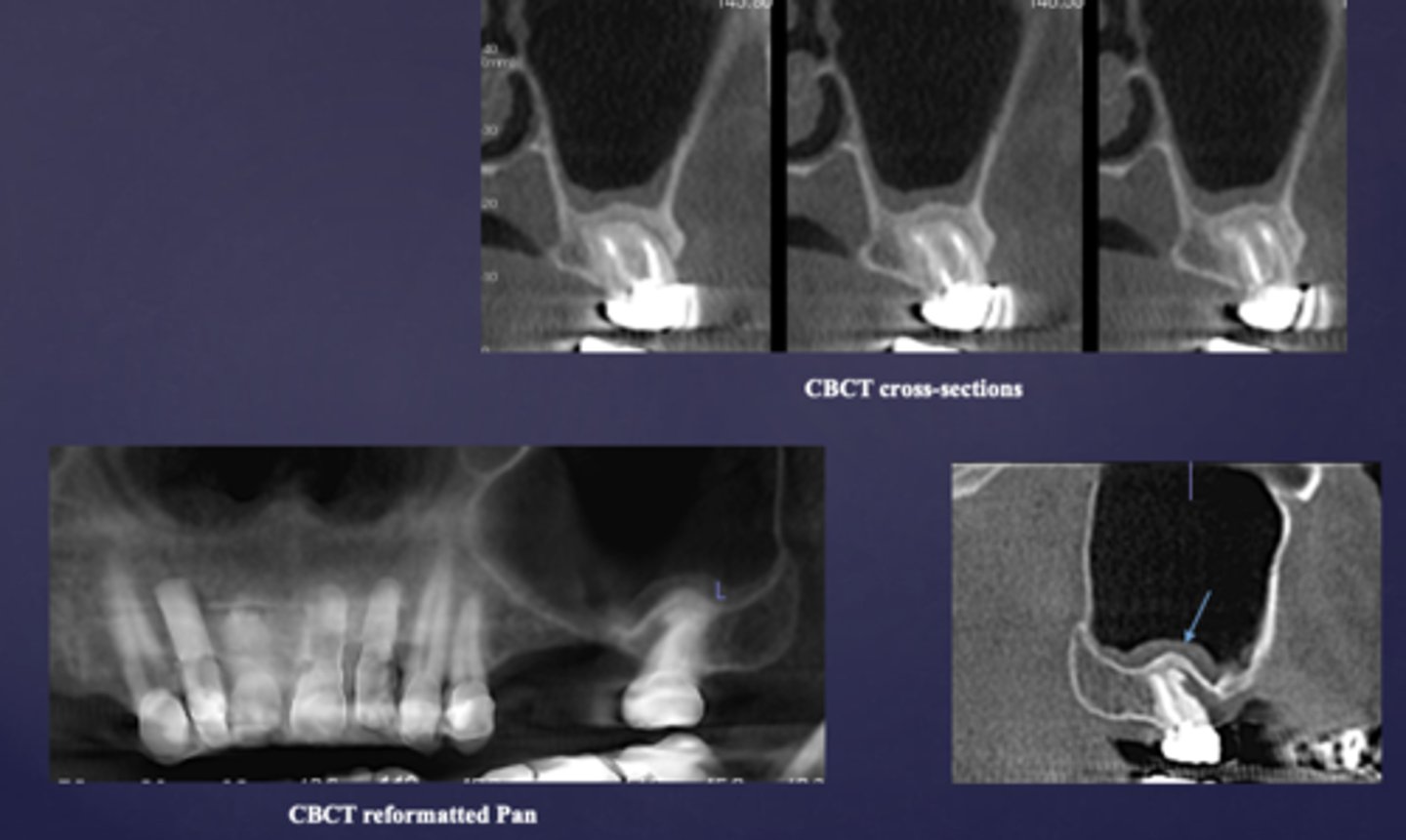 <p>What condition?</p>