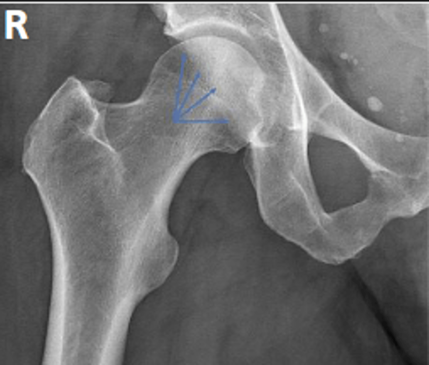 <p>What are the arrows pointing to?</p>