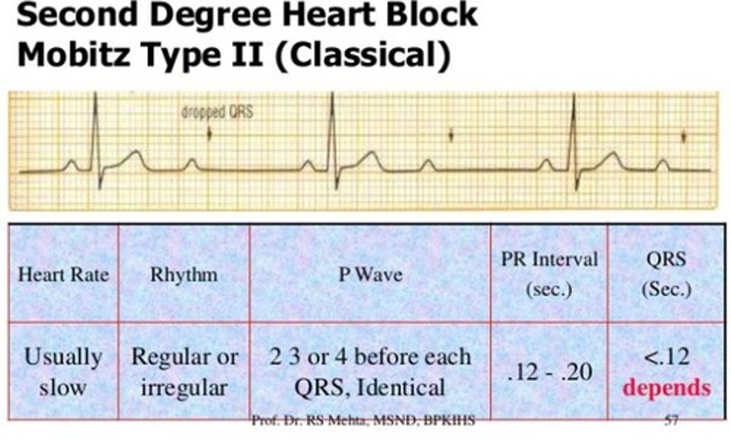<p>Series of nonconducted to conducted P waves is fixed. Consistent PR intervals, but not always followed by a QRS complex.</p>