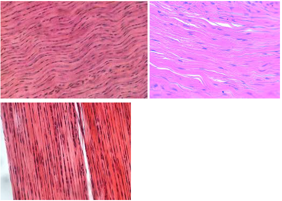 <ul><li><p>Characteristic: Has <strong>TIGHTLY PACKED COLLAGEN FIBERS </strong>that MAKE A <strong>WAVE-LIKE PATTERN </strong></p></li><li><p>Location: <strong>TENDONS/LIGAMENTS </strong></p></li><li><p>Function: <strong>STRENGTH</strong>  </p></li></ul><p></p>