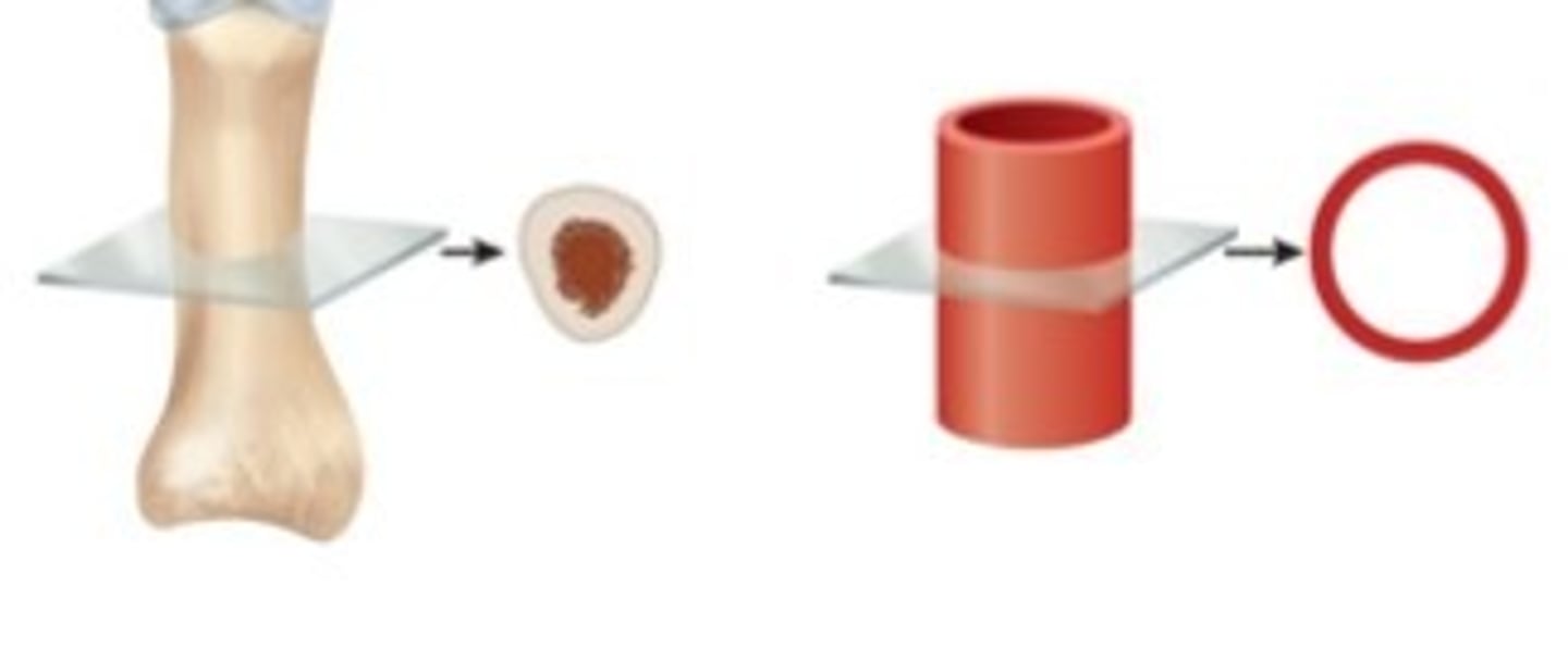 <p>cross section</p>